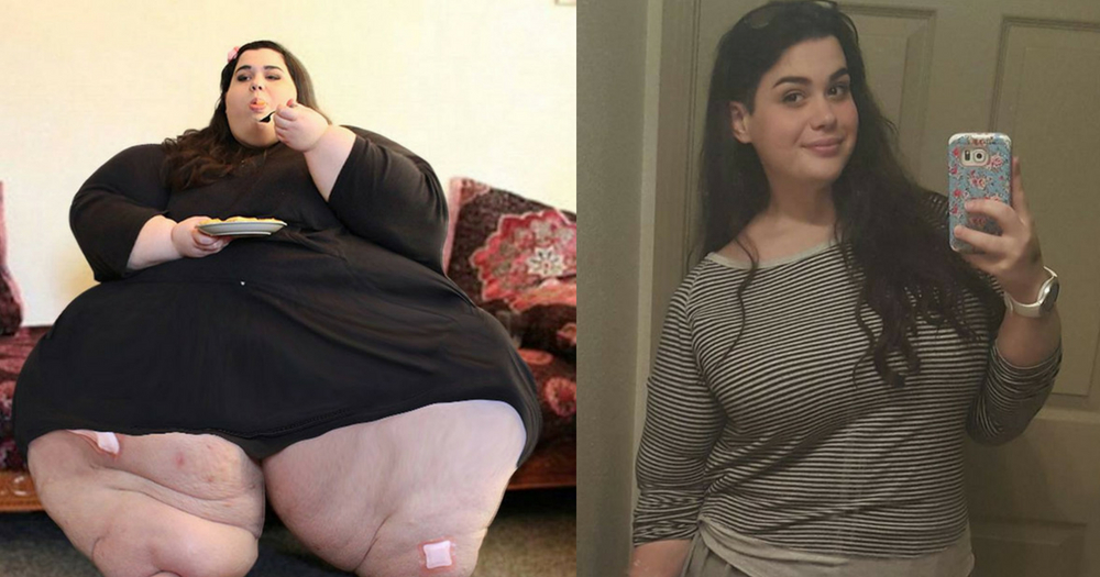 660 Pound Woman Loses 267 Pounds In The Course Of 1 Year