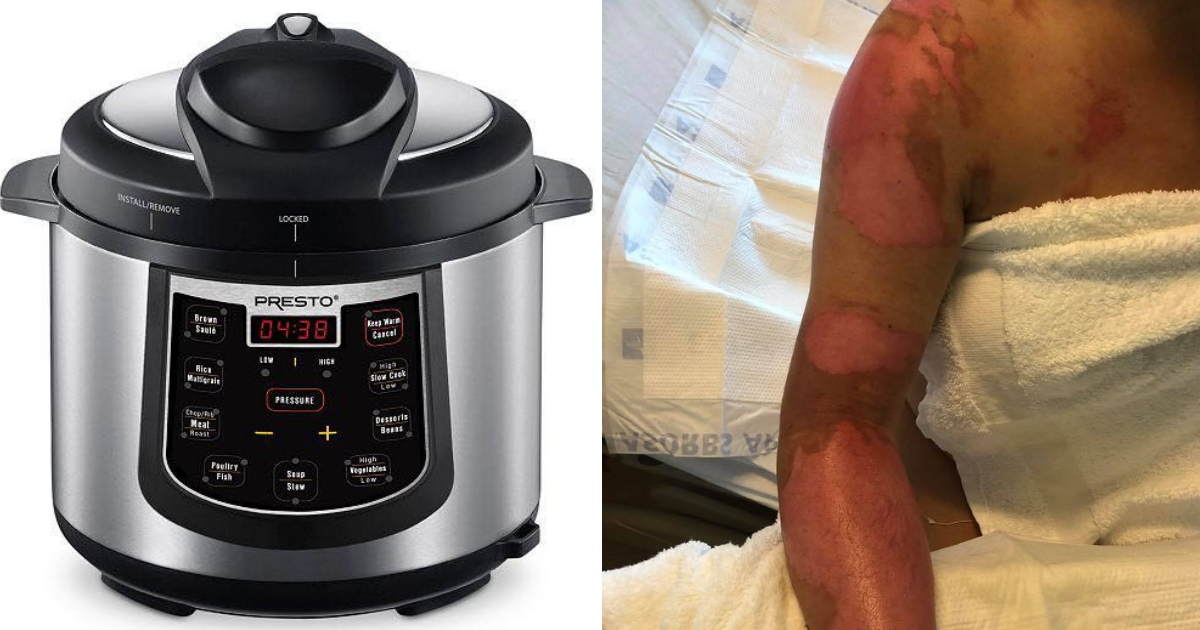 Mom Releases Warning After Pressure Cooker Leaves Her In Er With 2nd Degree Burns