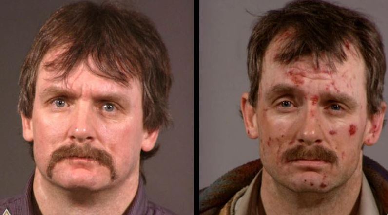 Shocking: These Images Will Make Sure You Never Ever Use Meth...