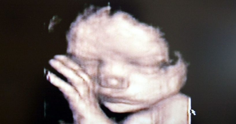 NEW ZEALAND - DECEMBER 01: Stock Photography. A 3D ultrasound showing a baby inside the womb.