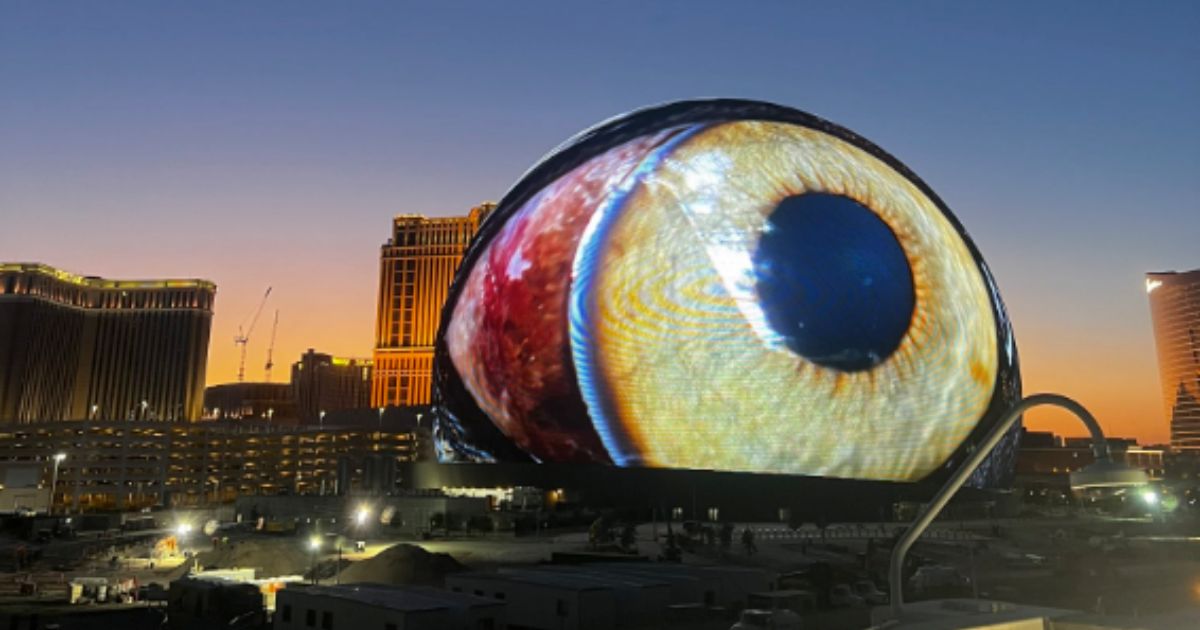 'Scariest Thing I've Ever Seen': Viral Video Shows Giant Eyeball Right ...