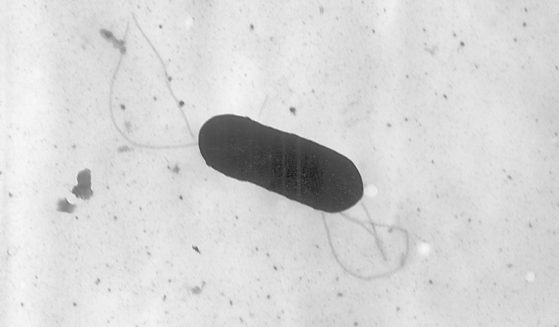 A 2002 electron microscope image made available by the Centers for Disease Control and Prevention shows a Listeria monocytogenes bacterium, responsible for the food borne illness listeriosis.