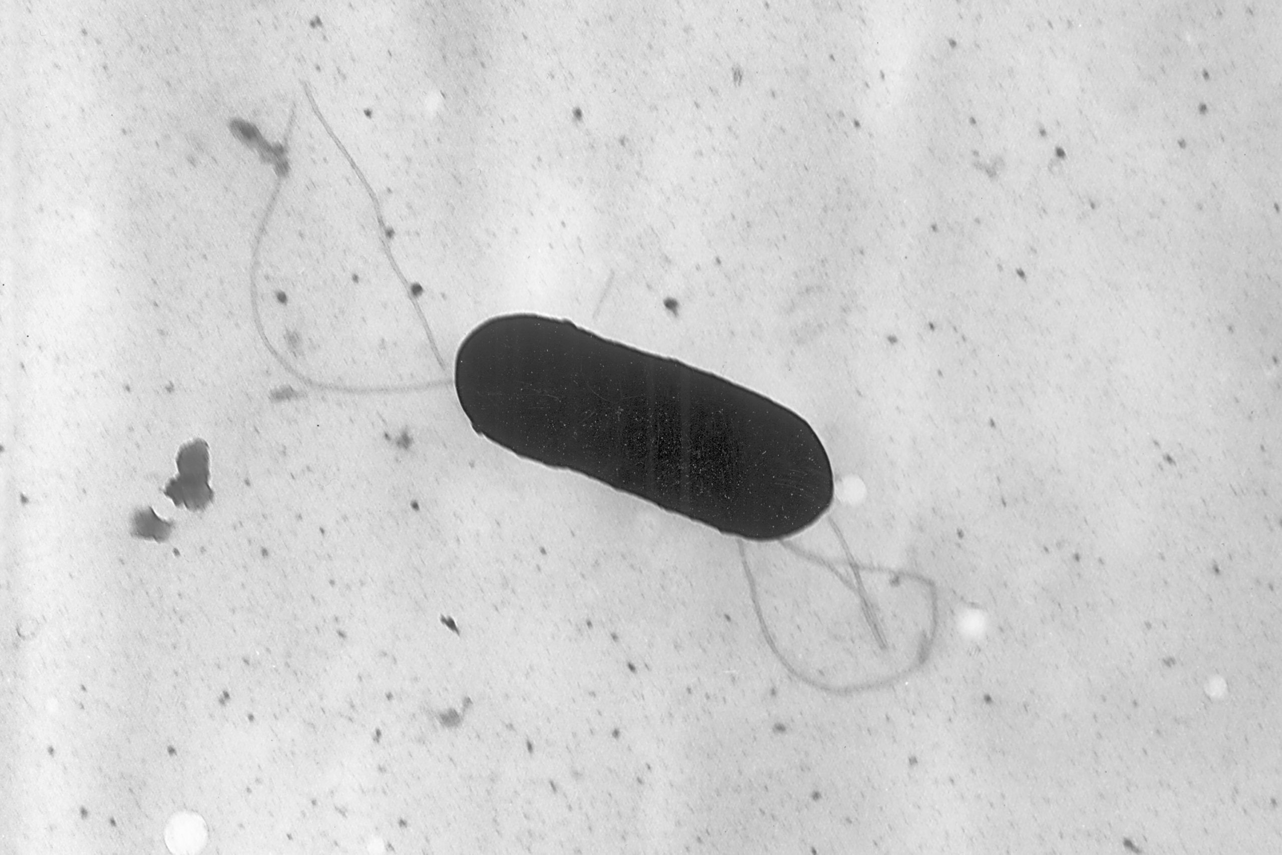 A Listeria monocytogenes bacterium is pictured in a 2002 electron microscope image.