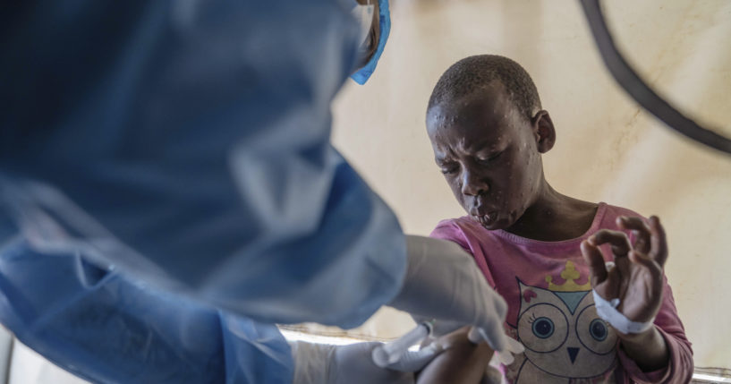 A health worker attends to a Mpox patient, at a treatment centre in Munigi, eastern Congo on Monday. Congo will receive the first vaccine doses to address its Mpox outbreak next week from the United States, the country's health minister said Monday, days after the World Health Organization declared Mpox outbreaks in Africa a global emergency.