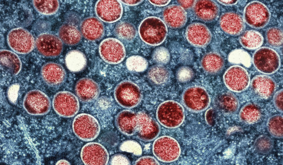 This undated image provided by the National Institute of Allergy and Infectious Diseases shows a colorized transmission electron micrograph of monkeypox particles (red) found within an infected cell (blue), cultured in the laboratory that was captured and color-enhanced at the NIAID Integrated Research Facility in Fort Detrick, Md.