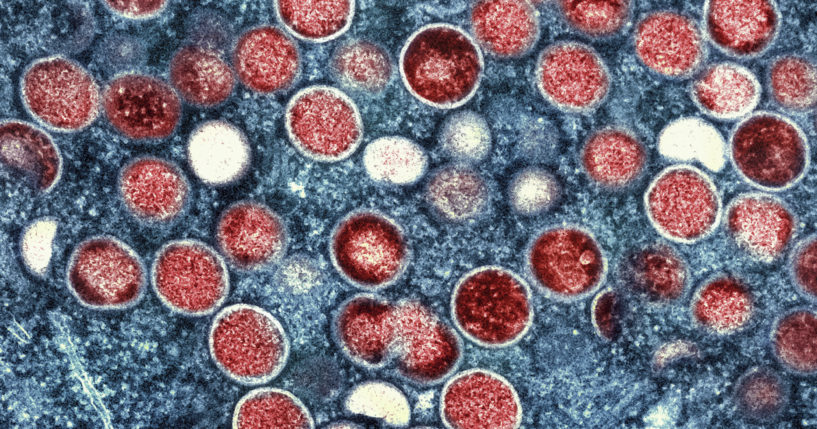 This undated image provided by the National Institute of Allergy and Infectious Diseases shows a colorized transmission electron micrograph of monkeypox particles (red) found within an infected cell (blue), cultured in the laboratory that was captured and color-enhanced at the NIAID Integrated Research Facility in Fort Detrick, Md.