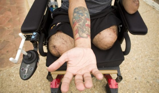 Iraq war veteran Sgt. Luis Rosa-Valentin, who lost both of his legs, left arm and hearing while serving in Iraq shows the tattoo he got in memory of a friend killed in Iraq, at Walter Reed Army Medical Center in Washington, D.C., on July 30, 2008.