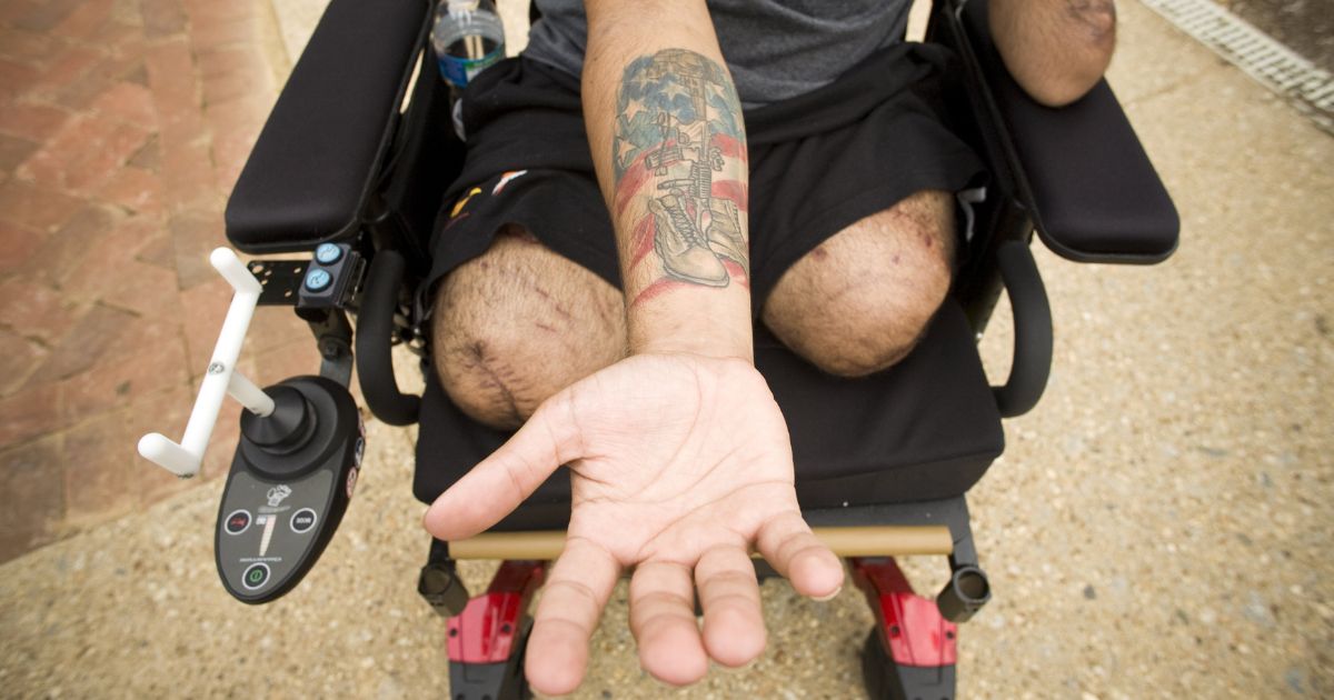 Iraq war veteran Sgt. Luis Rosa-Valentin, who lost both of his legs, left arm and hearing while serving in Iraq shows the tattoo he got in memory of a friend killed in Iraq, at Walter Reed Army Medical Center in Washington, D.C., on July 30, 2008.